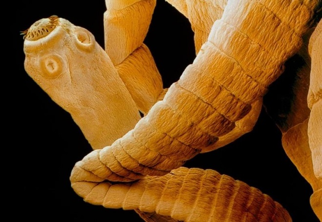 Свиной цепень - возбудитель нейроцистицеркоза