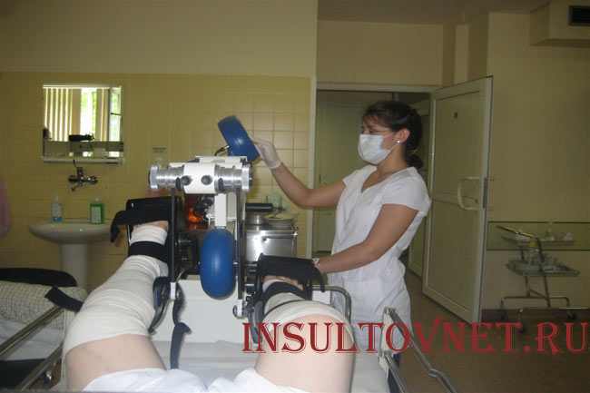 Ранняя реабилитация после инсульта