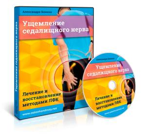 Ущимление седалищного нерва