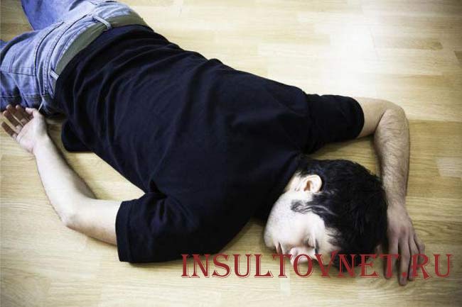 Симптомы эпилептического припадка