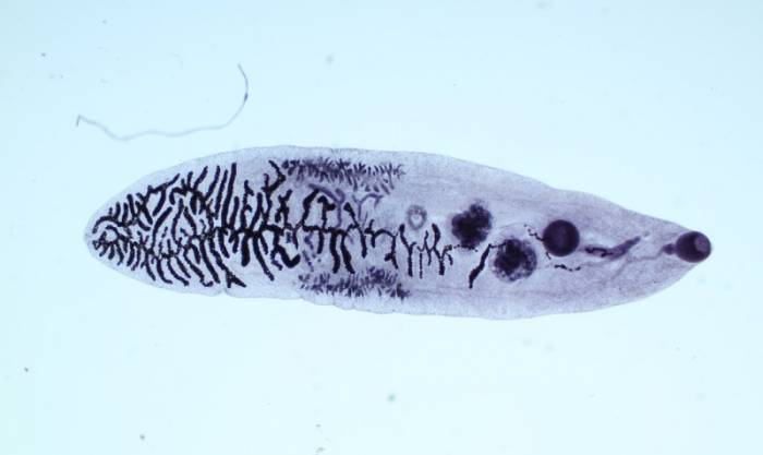Печеночный сосальщик