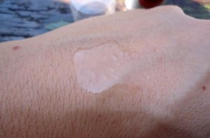 жидкий пластырь для кожи применение