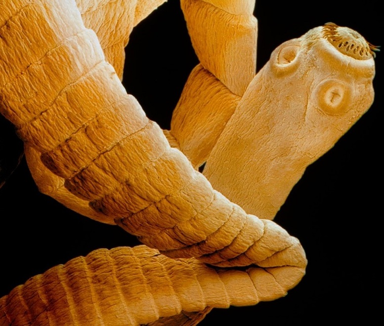 Как выглядит карликовый цепень