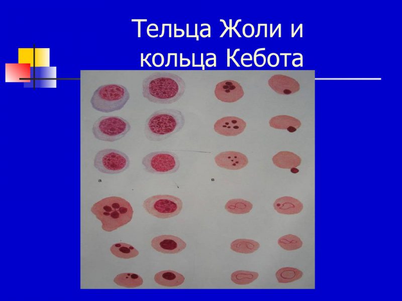 Тельца Жоли и кольца Кебота