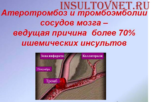 коллатеральный кровоток