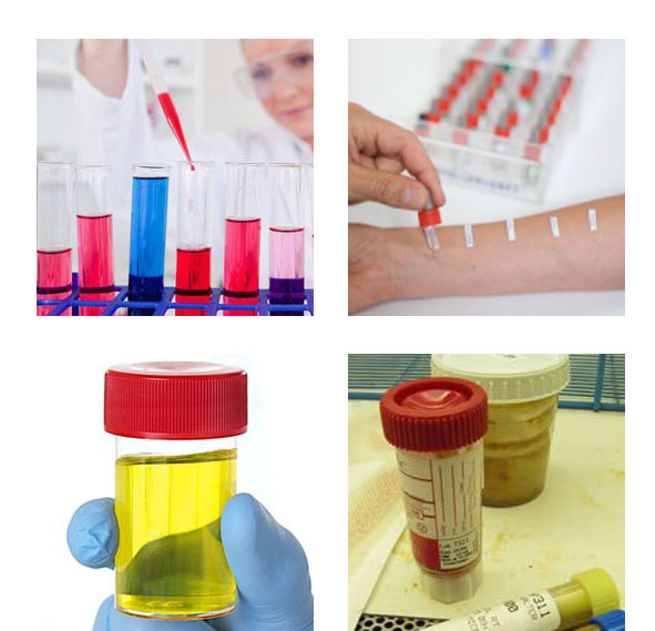 анализ на глисты