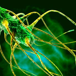 Каким образом происходит заражение сальмонеллезом