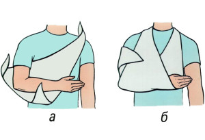 Схема наложения повязки на руку Первая помощь при вывихе запястья