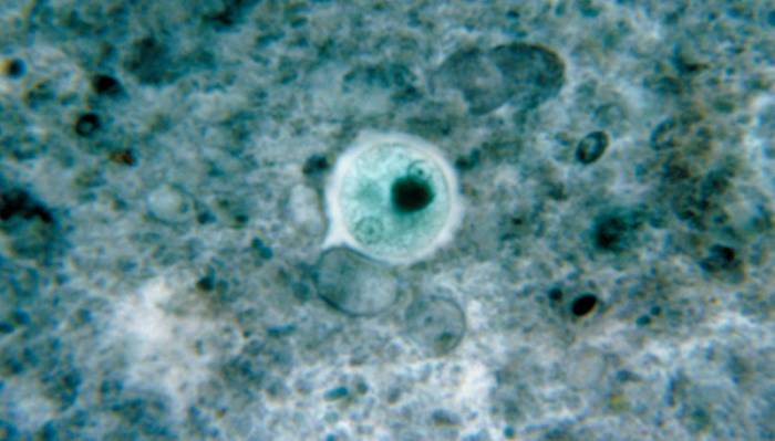 амеба дизентерийная