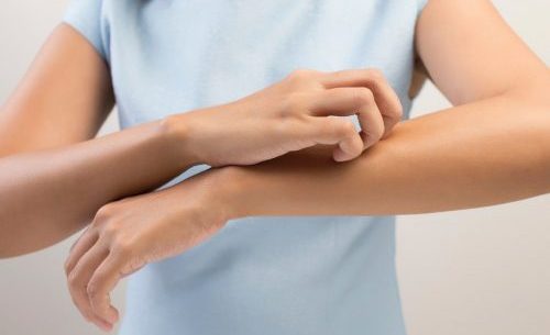 Как проявляется стронгилоидоз