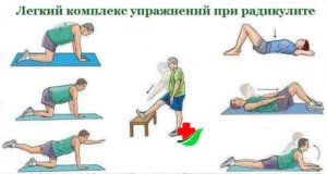 Комплекс упражнений при радикулите