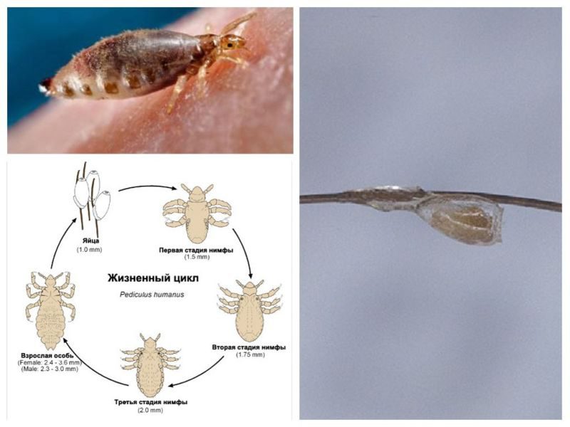 Жизненный цикл вшей