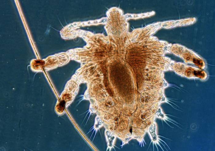 Лобковая вошь