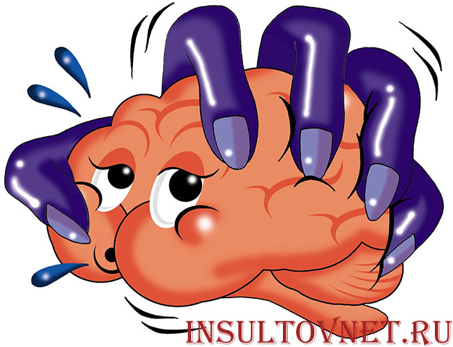 мозговой удар