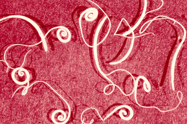 Цикл развития власоглава