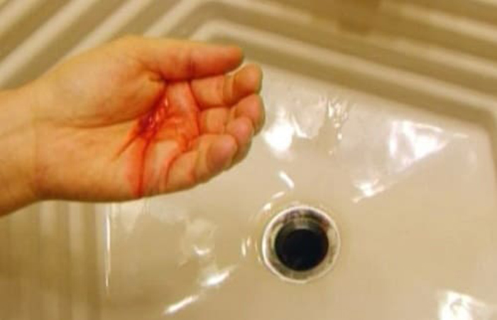 кашель с кровью