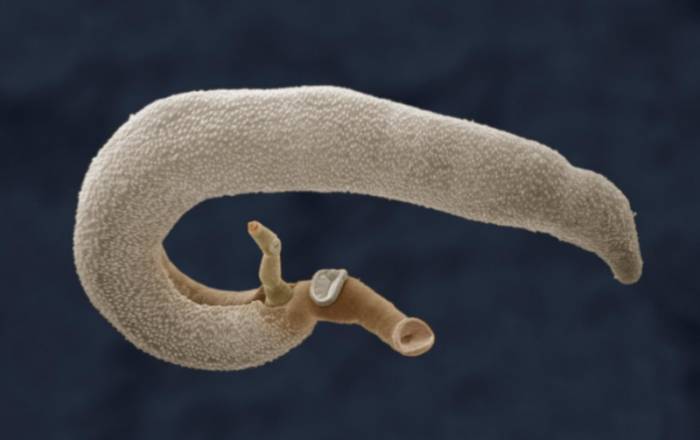 Шистосома мансони