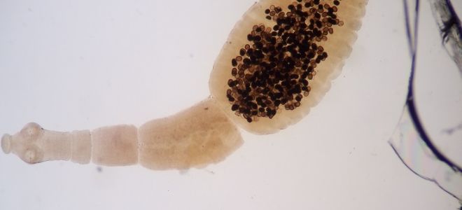 Эхинококкоз печени