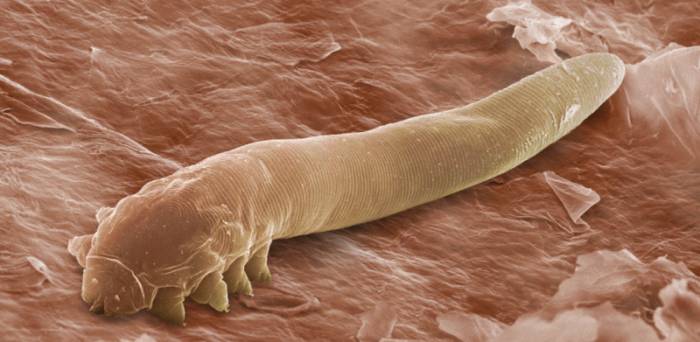 Клещ Демодекс