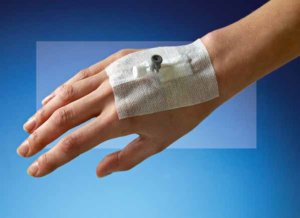 Пластырь для периферических катетеров тканевый