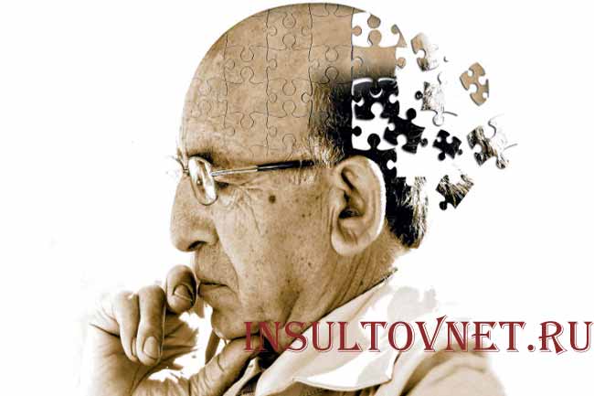 Тестирование на болезнь Альцгеймера