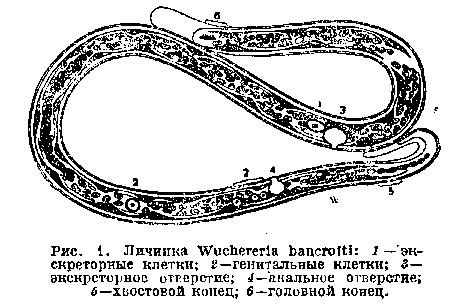 Вухерерия Банкрофта