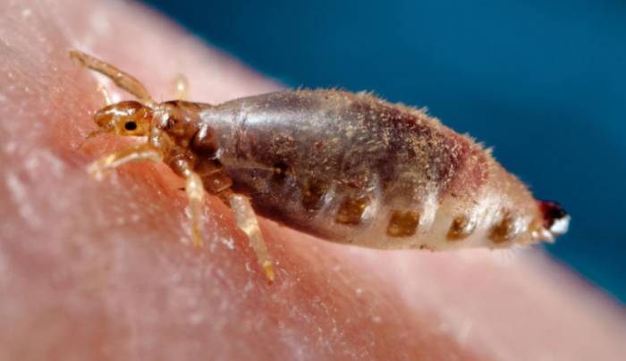 вши платяные