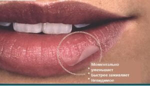 Эффективность пластыря Компид от герпеса