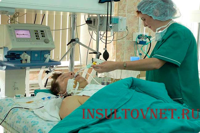 Реанимация при инсульте