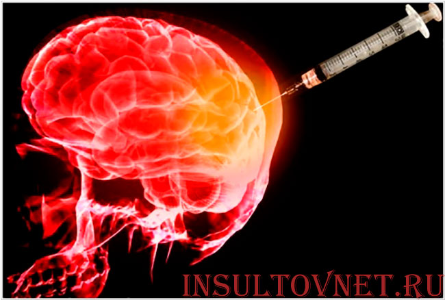 лечение Альцгеймера