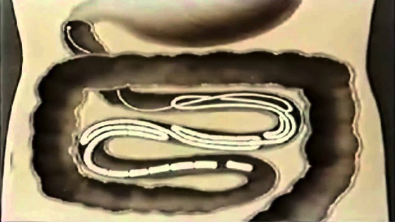 Ленточные черви