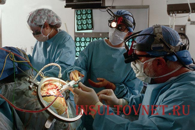 Удаление гематомы