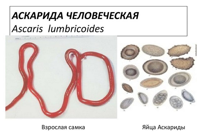аскарида человеческая