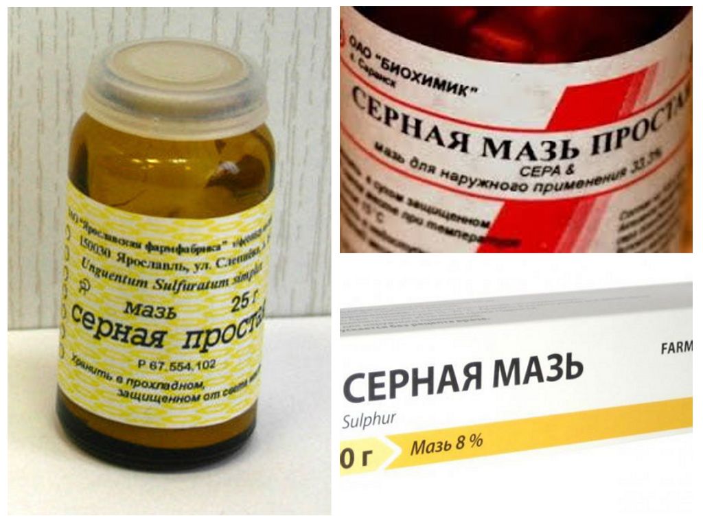 Демодекоз волосистой части головы