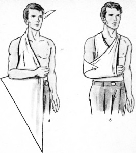 косынка на руку Иммобилизация руки с помощью косынки