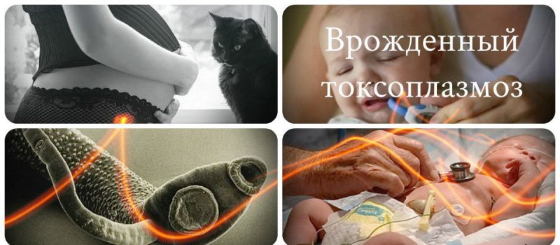 врожденный токсопламоз