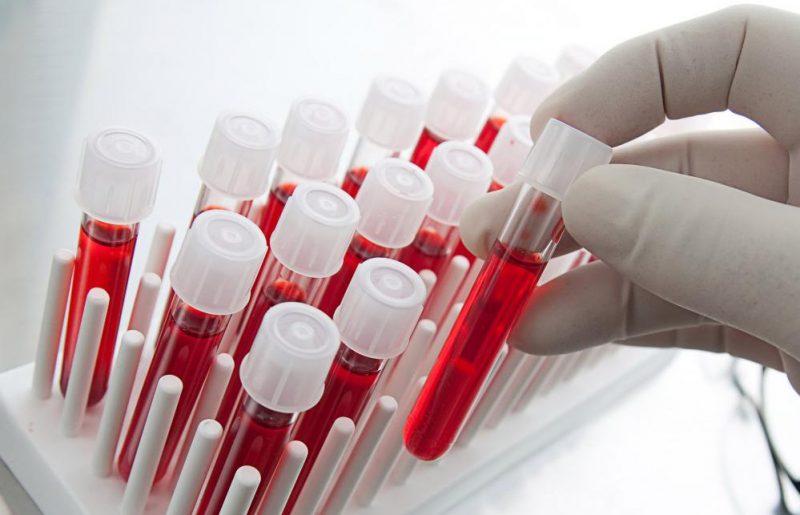 общий анализ крови