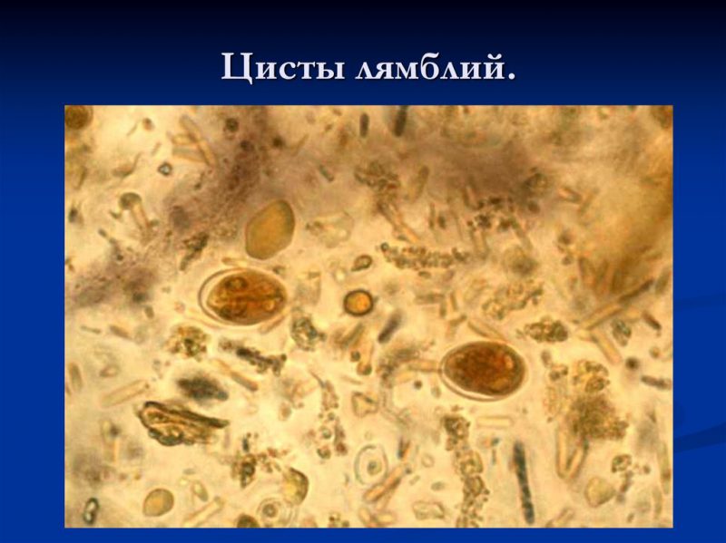 цисты лямблий