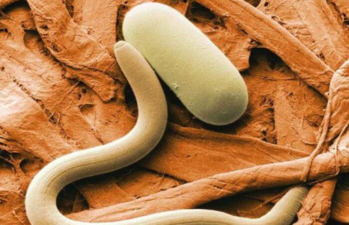 лечение власоглава