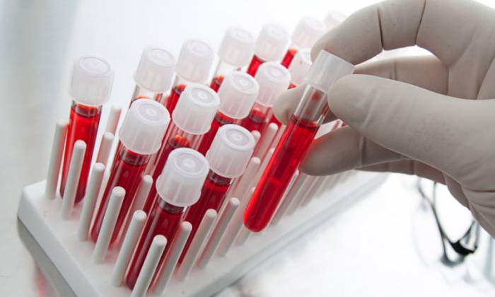 анализ крови