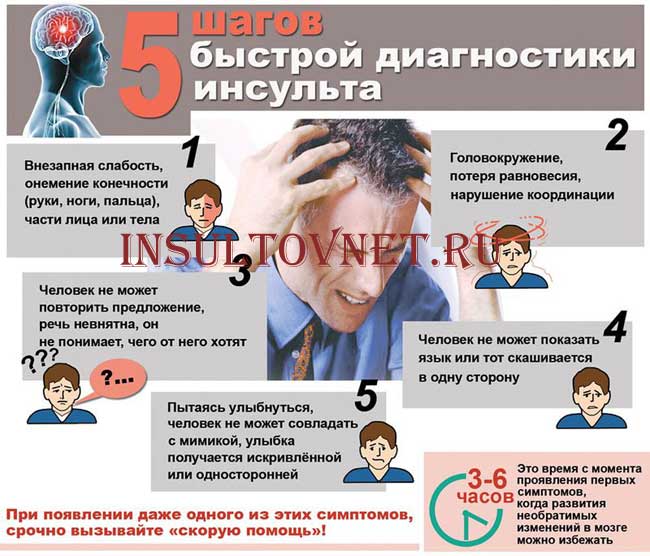 симптомы инсульта