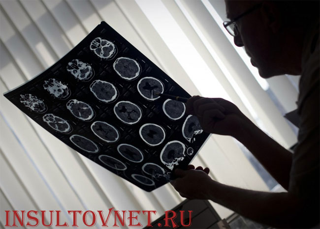 исследование