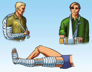 Виды шин Шины при переломах