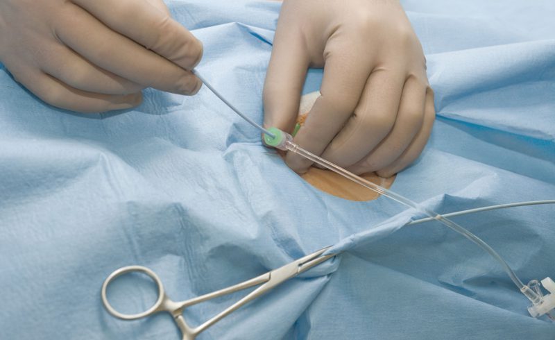 комплексная медикаментозная терапия