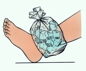 При закрытом переломе на место травмы нужно положить лед