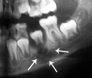 Рентген Рентген челюсти
