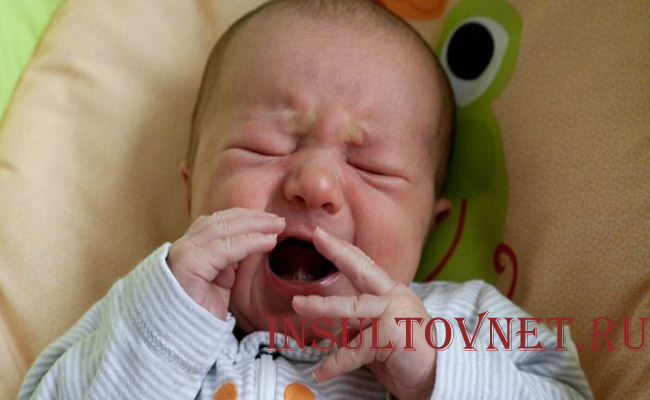 Невралгия тройничного нерва у детей