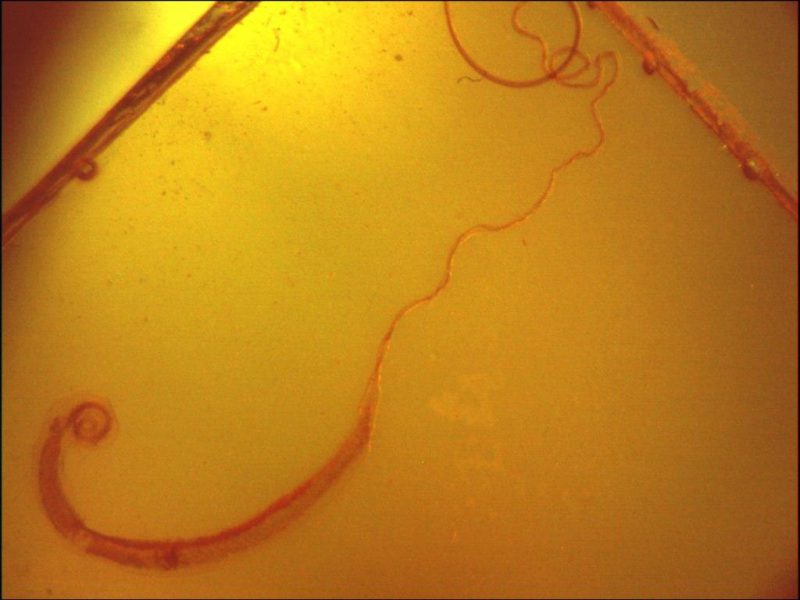 диагностика власоглава