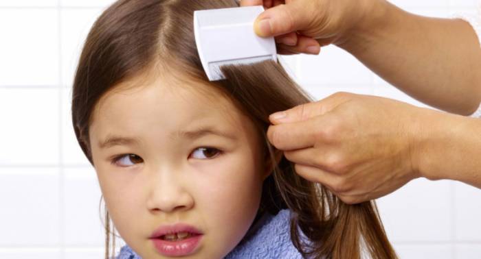 педикулёз у детей