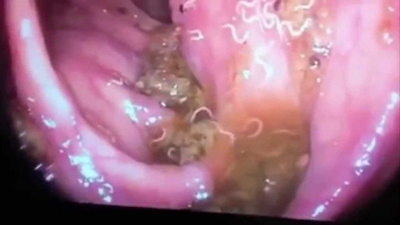 развитие патологии